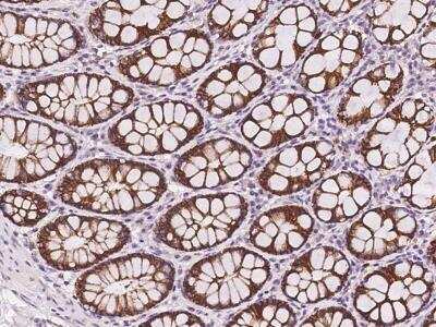Immunohistochemistry-Paraffin: Kv11.3 Antibody [NBP3-06083]