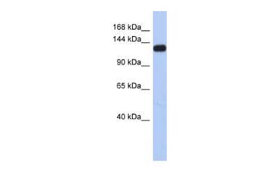 Western Blot: Kv11.3 Antibody [NBP2-85183]