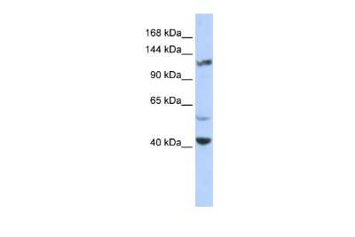 Western Blot: Kv12.2 Antibody [NBP2-85187]