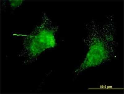 Immunocytochemistry/ Immunofluorescence: Kv3.3 Antibody (1C1) [H00003748-M01]