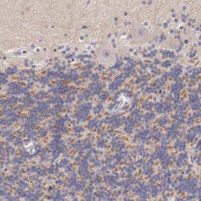 Immunohistochemistry-Paraffin: Kv4.1 Antibody [NBP1-81336]