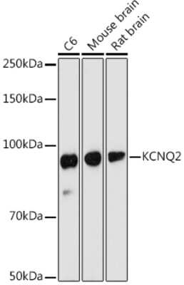Western Blot: Kv7.2 AntibodyAzide and BSA Free [NBP3-03616]