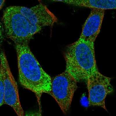 Immunocytochemistry/ Immunofluorescence: Kv7.2 Antibody [NBP2-38820]