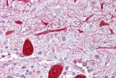 Immunohistochemistry: Kv7.2 Antibody [NBP2-85191]