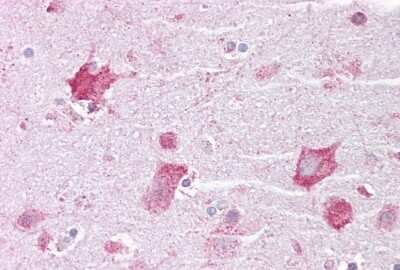 Immunohistochemistry: Kv7.2 Antibody [NBP2-85192]