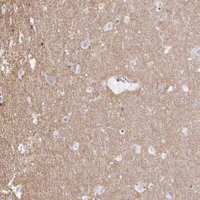 Immunohistochemistry-Paraffin: Kv7.2 Antibody [NBP2-38820]