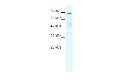 Western Blot: Kv7.2 Antibody [NBP2-85190]