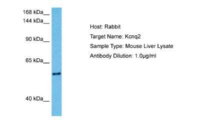 Western Blot: Kv7.2 Antibody [NBP2-85191]