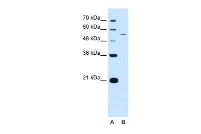 Western Blot: Kv7.2 Antibody [NBP2-85192]
