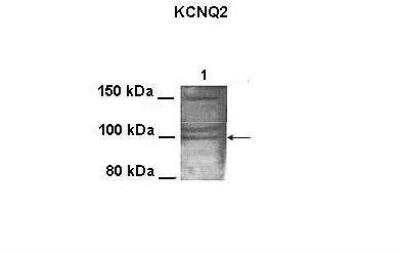 Western Blot: Kv7.2 Antibody [NBP2-85192]