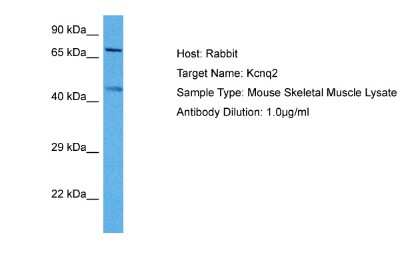 Western Blot: Kv7.2 Antibody [NBP2-85193]