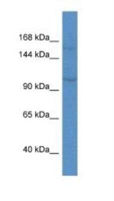 Western Blot: Kv7.3 Antibody [NBP1-74102]