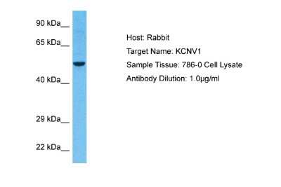 Western Blot: Kv8.1 Antibody [NBP2-37847]