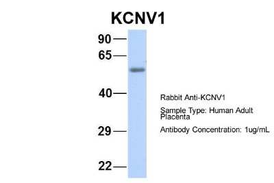 Western Blot: Kv8.1 Antibody [NBP2-84129]