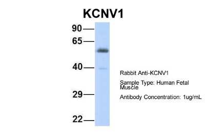 Western Blot: Kv8.1 Antibody [NBP2-84129]
