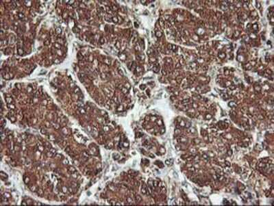 Immunohistochemistry-Paraffin: KvBeta1 Antibody (OTI4E7) [NBP2-01526]