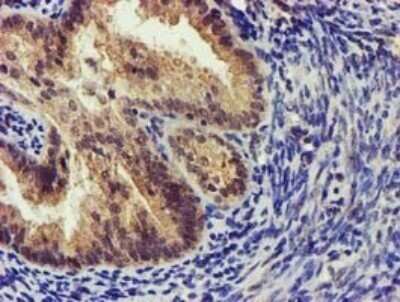 Immunohistochemistry: KvBeta1 Antibody (OTI7F12) - Azide and BSA Free [NBP2-71349]