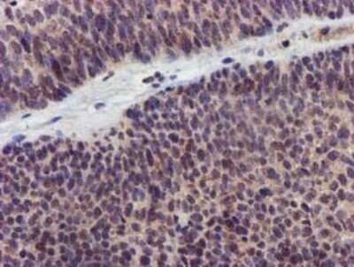 Immunohistochemistry: KvBeta1 Antibody (OTI7F12) - Azide and BSA Free [NBP2-71349]