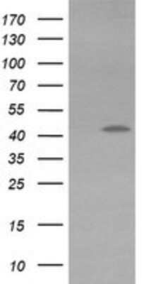 Western Blot: KvBeta1 Antibody (OTI7F12)Azide and BSA Free [NBP2-71349]
