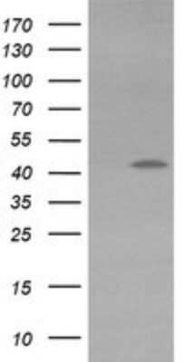 Western Blot: KvBeta1 Antibody (OTI7F12) [NBP2-45767]