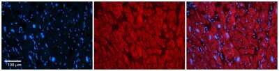Immunohistochemistry: KvBeta2 Antibody [NBP1-80096]