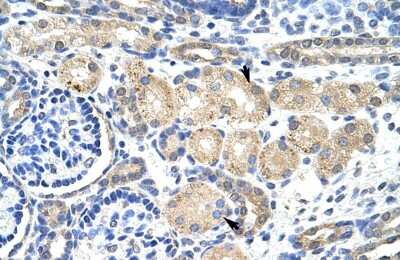 Immunohistochemistry: KvBeta2 Antibody [NBP1-80271]