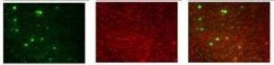 Immunohistochemistry-Paraffin: KvBeta2 Antibody [NBP1-80271]