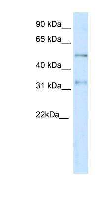 Western Blot: KvBeta2 Antibody [NBP1-80271]