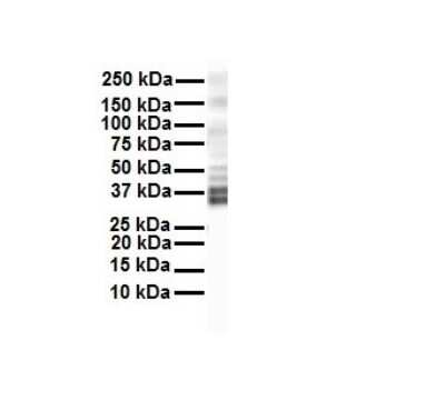 Western Blot: KvBeta2 Antibody [NBP1-80271]