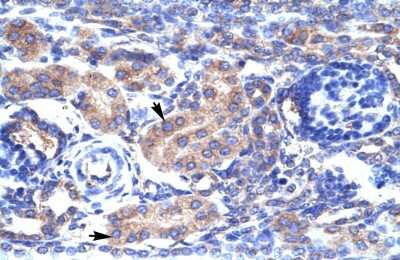 Immunohistochemistry: KvBeta3 Antibody [NBP2-83134]