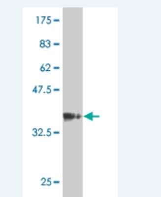 Western Blot: KxDL motif containing 1 Antibody (4C9) [H00079036-M07]