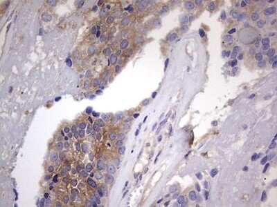 Immunohistochemistry: Kynureninase Antibody (OTI1H1) [NBP2-45579]