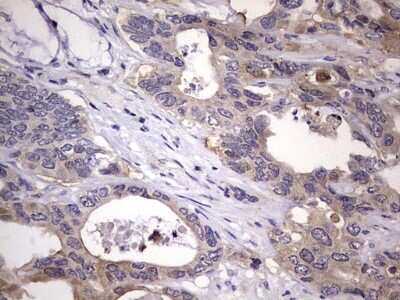 Immunohistochemistry: Kynureninase Antibody (OTI1H1) [NBP2-45579]