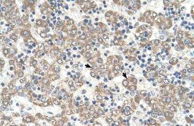 Immunohistochemistry-Paraffin: Kynureninase Antibody [NBP1-56545]