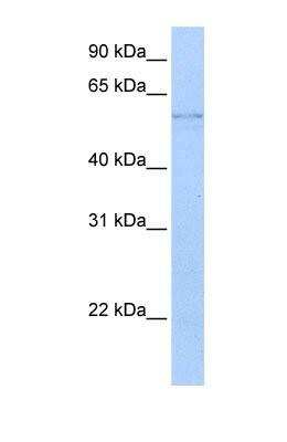 Western Blot: Kynureninase Antibody [NBP1-56545]