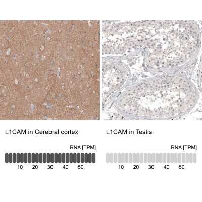 Immunohistochemistry-Paraffin: L1CAM Antibody (CL12984) [NBP3-18568]