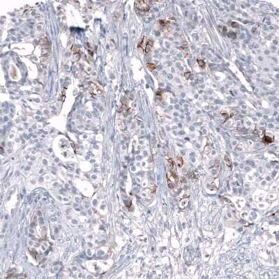 Immunohistochemistry-Paraffin: L1CAM Antibody (CL12984) [NBP3-18568]