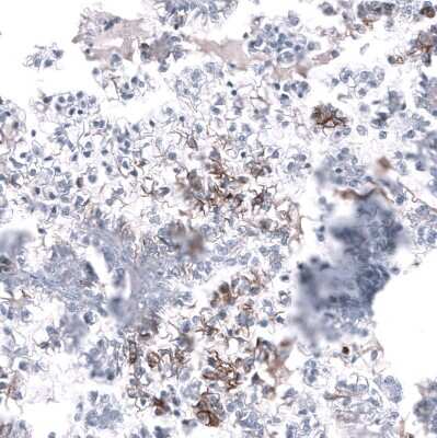 Immunohistochemistry-Paraffin: L1CAM Antibody (CL12984) [NBP3-18568]