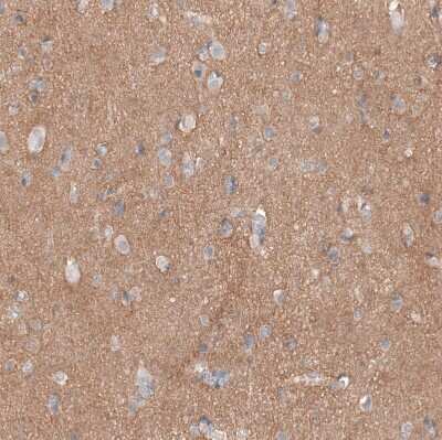 Immunohistochemistry-Paraffin: L1CAM Antibody (CL12984) [NBP3-18568]