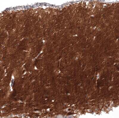 Immunohistochemistry-Paraffin: L1CAM Antibody (CL12984) [NBP3-18568]