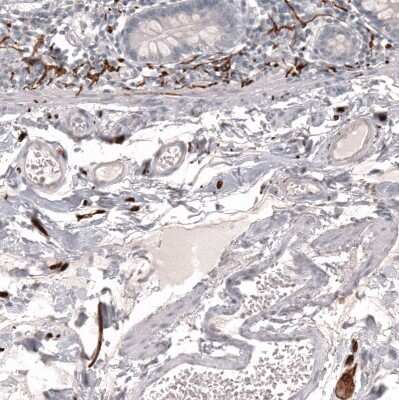 Immunohistochemistry-Paraffin: L1CAM Antibody (CL12984) [NBP3-18568]