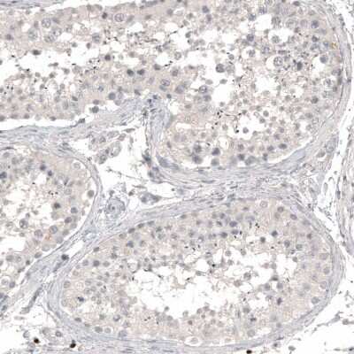 Immunohistochemistry-Paraffin: L1CAM Antibody (CL12984) [NBP3-18568]