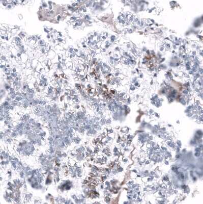Immunohistochemistry-Paraffin: L1CAM Antibody (CL12988) [NBP3-18553]