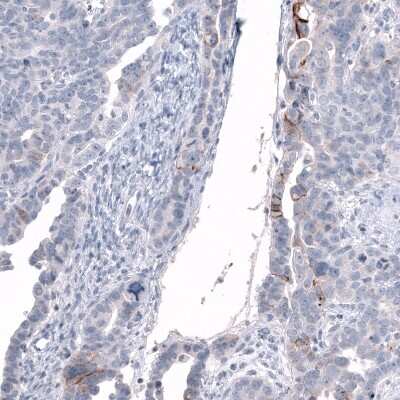 Immunohistochemistry-Paraffin: L1CAM Antibody (CL12988) [NBP3-18553]