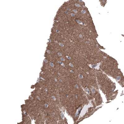 Immunohistochemistry-Paraffin: L1CAM Antibody (CL12988) [NBP3-18553]