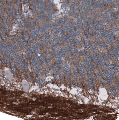 Immunohistochemistry-Paraffin: L1CAM Antibody (CL12988) [NBP3-18553]