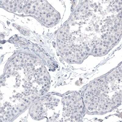 Immunohistochemistry-Paraffin: L1CAM Antibody (CL12988) [NBP3-18553]