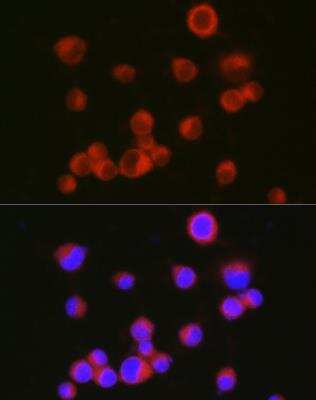 Immunocytochemistry/ Immunofluorescence: L1CAM Antibody - BSA Free [NBP3-03276]