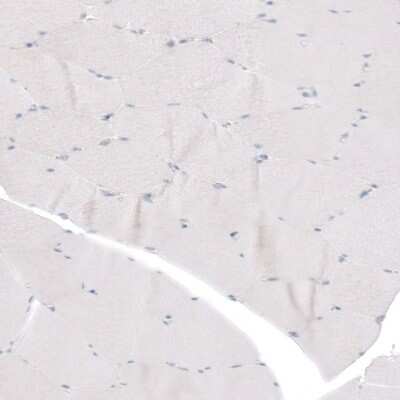 Immunohistochemistry-Paraffin: L1CAM Antibody [NBP1-86544]