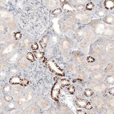 Immunohistochemistry-Paraffin: L1CAM Antibody [NBP1-86544]